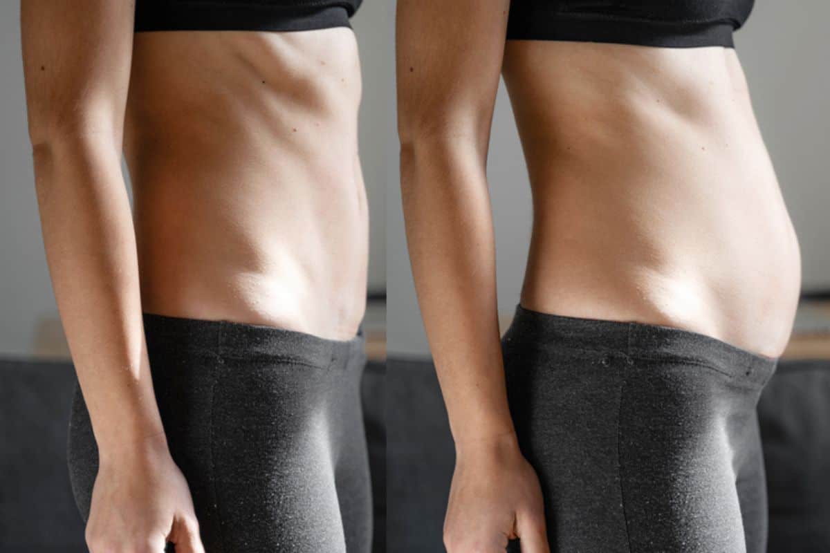 How long does diastasis recti take to improve Stockport?