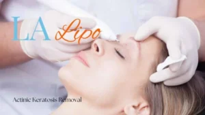 Woman receiving Actinic Keratosis Removal Treatment Stockport