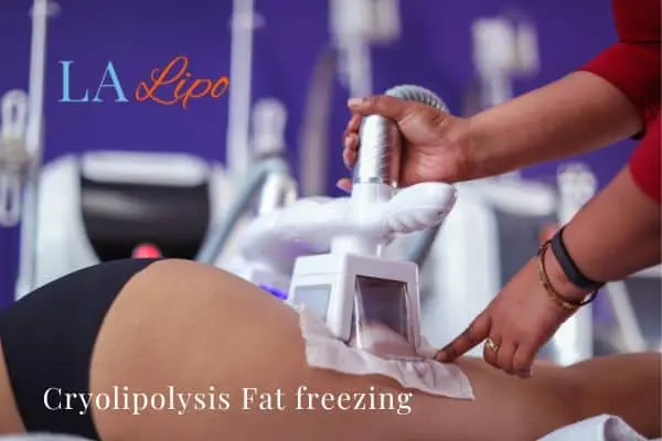 women getting fat freezing Stockport
