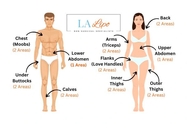 LA LIPO Cryolipolysis Areas Stockport