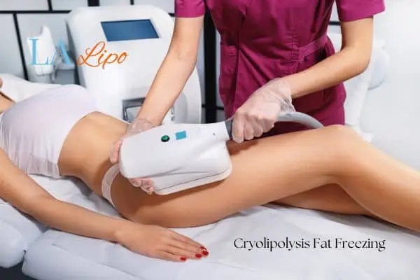 Woman receiving coolsculpting Stockport treatment on her thighs