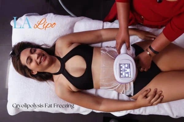 woman getting cryolipolysis Stockport