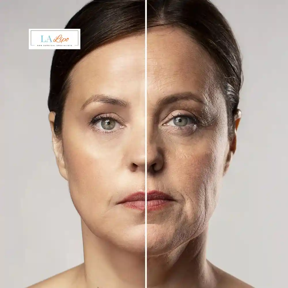 How Can You Tell If Non-Surgical Skin Tightening Is Right for You Stockport?