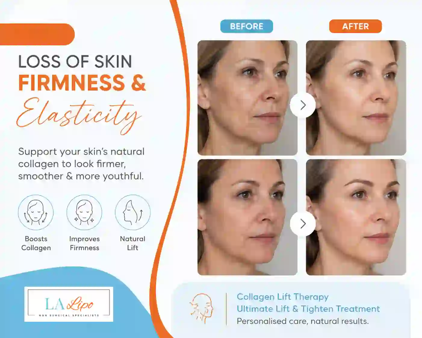 Sign #7: Loss of Skin Firmness and Elasticity Stockport